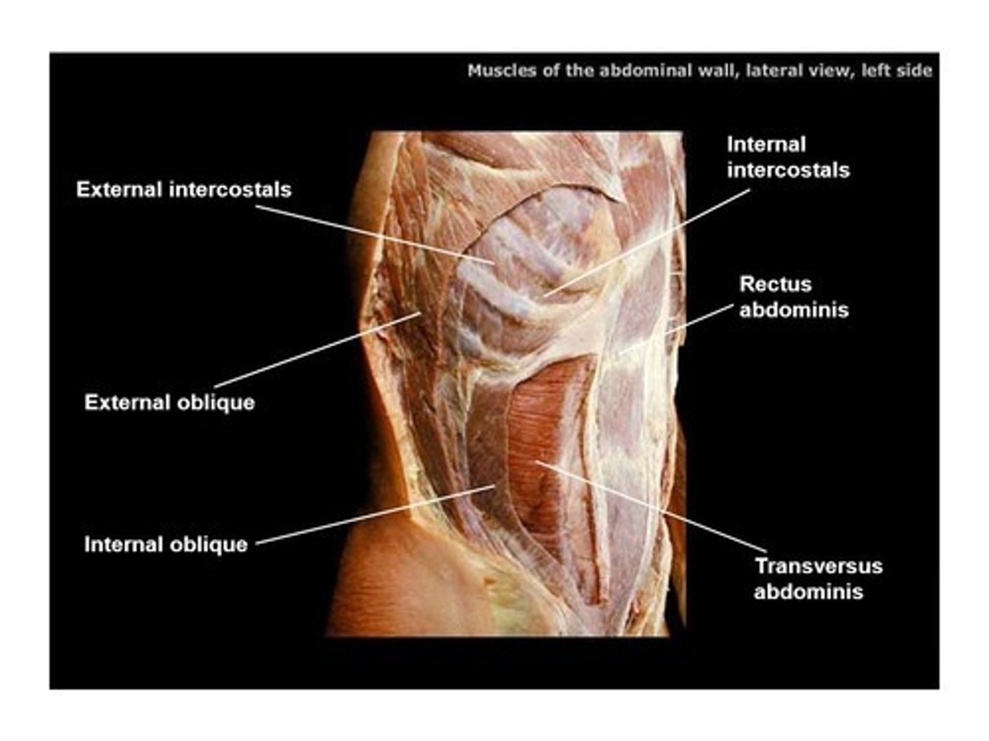 <p>name this muscle "\ /" " "/ \"</p>