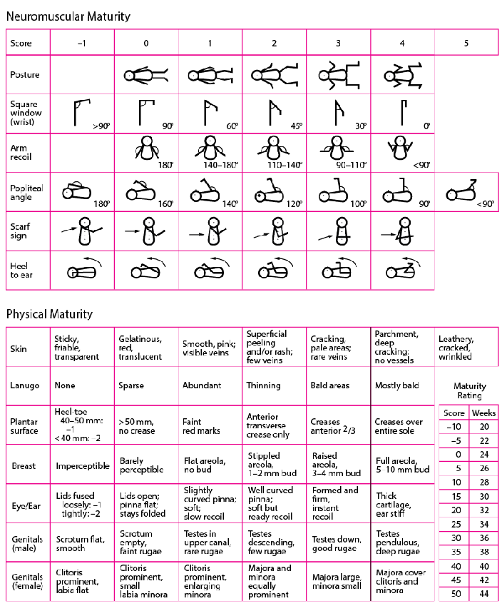 When determining a newborn’s gestional age using the ballard score, what would indicate low neuromusclar maturity?