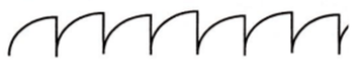 <p>jerk nystagmus where the velocity of the slow phase wave form is decreasing instead of increasing. Found in patients using drugs, having cerebellar or vestibular problems, or having MS.</p>