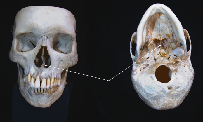name the bone 