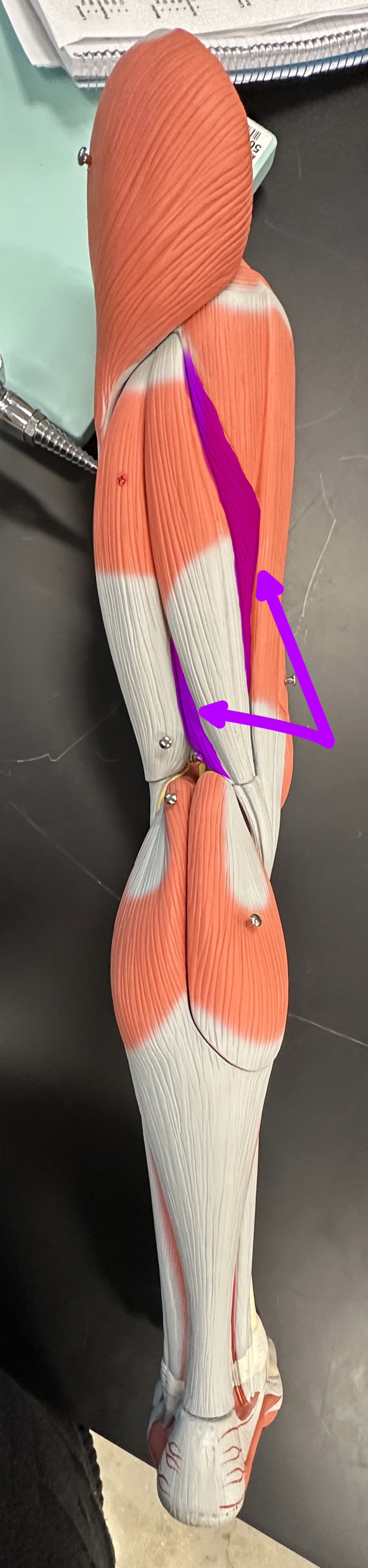 <p>What is the highlighted structure</p>