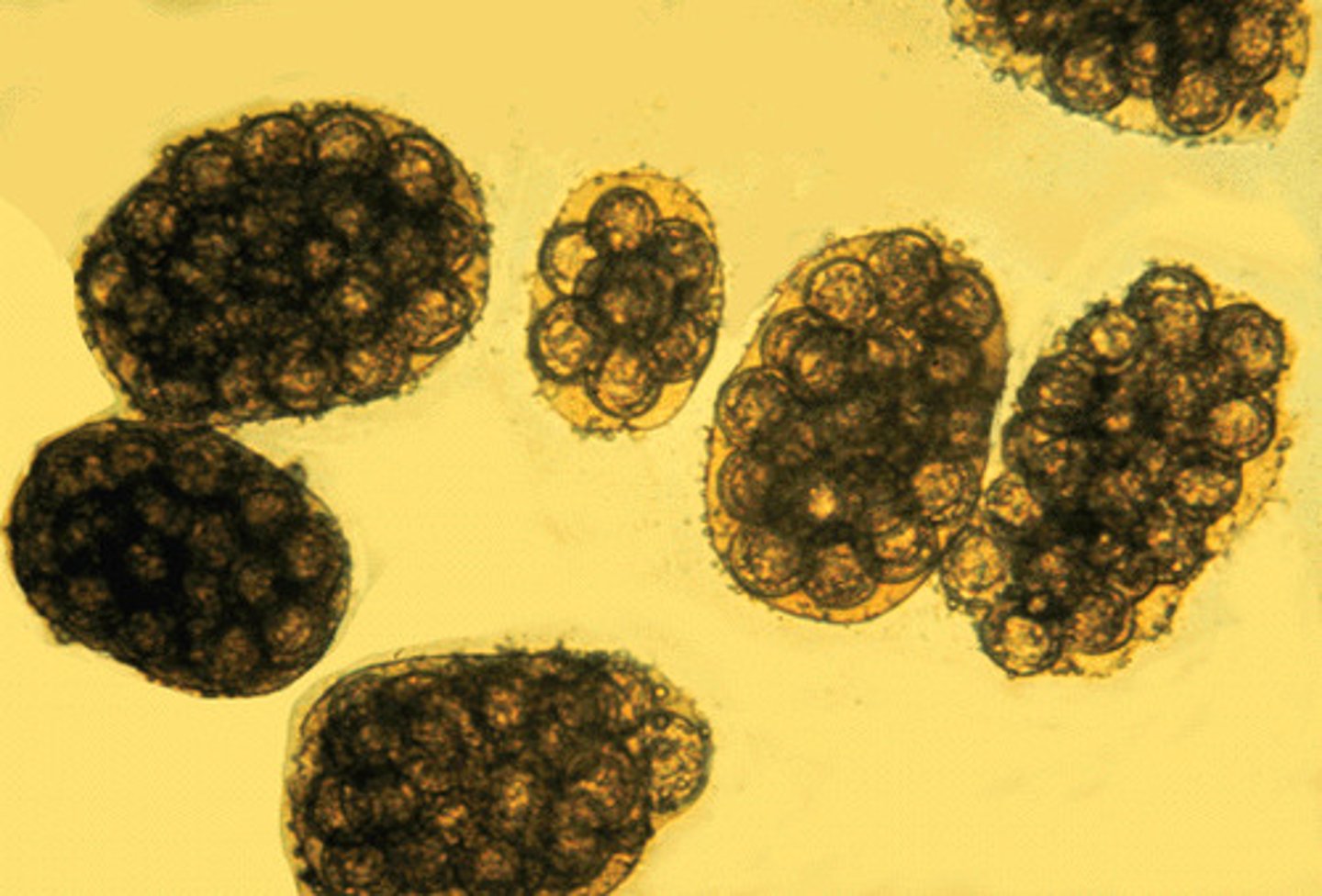 <p>passed anally within mobile segments from an infected dog. Once outside the body, these segments dry out and release their egg cargo.</p>