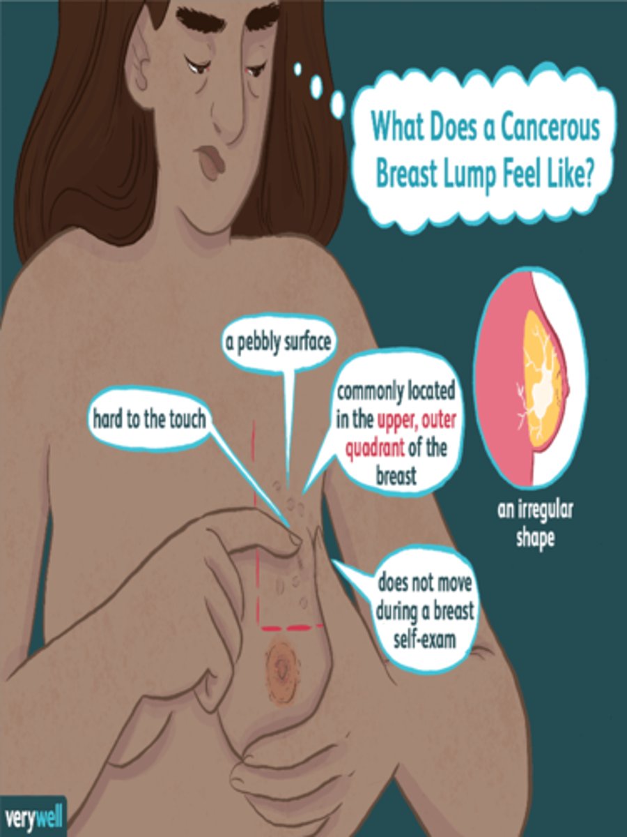 <p>As with clock face, describe distance in centimeters from nipple; or diagram breast in woman’s record and mark in location of lump.</p>