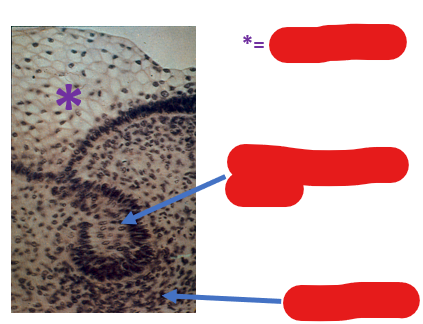 <p>What are the components of a tooth bud? Identify them in this image</p>