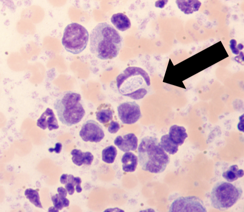 <p>What is the black arrow pointing to? </p>