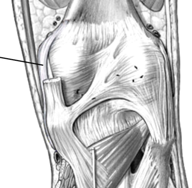 <p>Which ligament of the knee:</p><ul><li><p>Extends from the medial epicondyle of the femur to the tibia</p></li><li><p>Located on the medial side of the knee joint</p></li></ul><p></p>