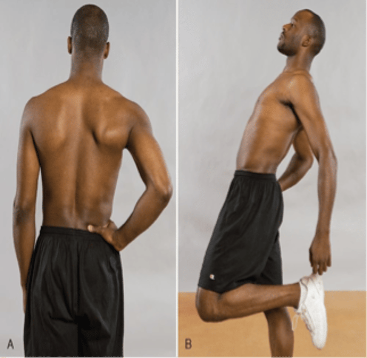 <p>Patient stands on one leg and hyperextends back</p>