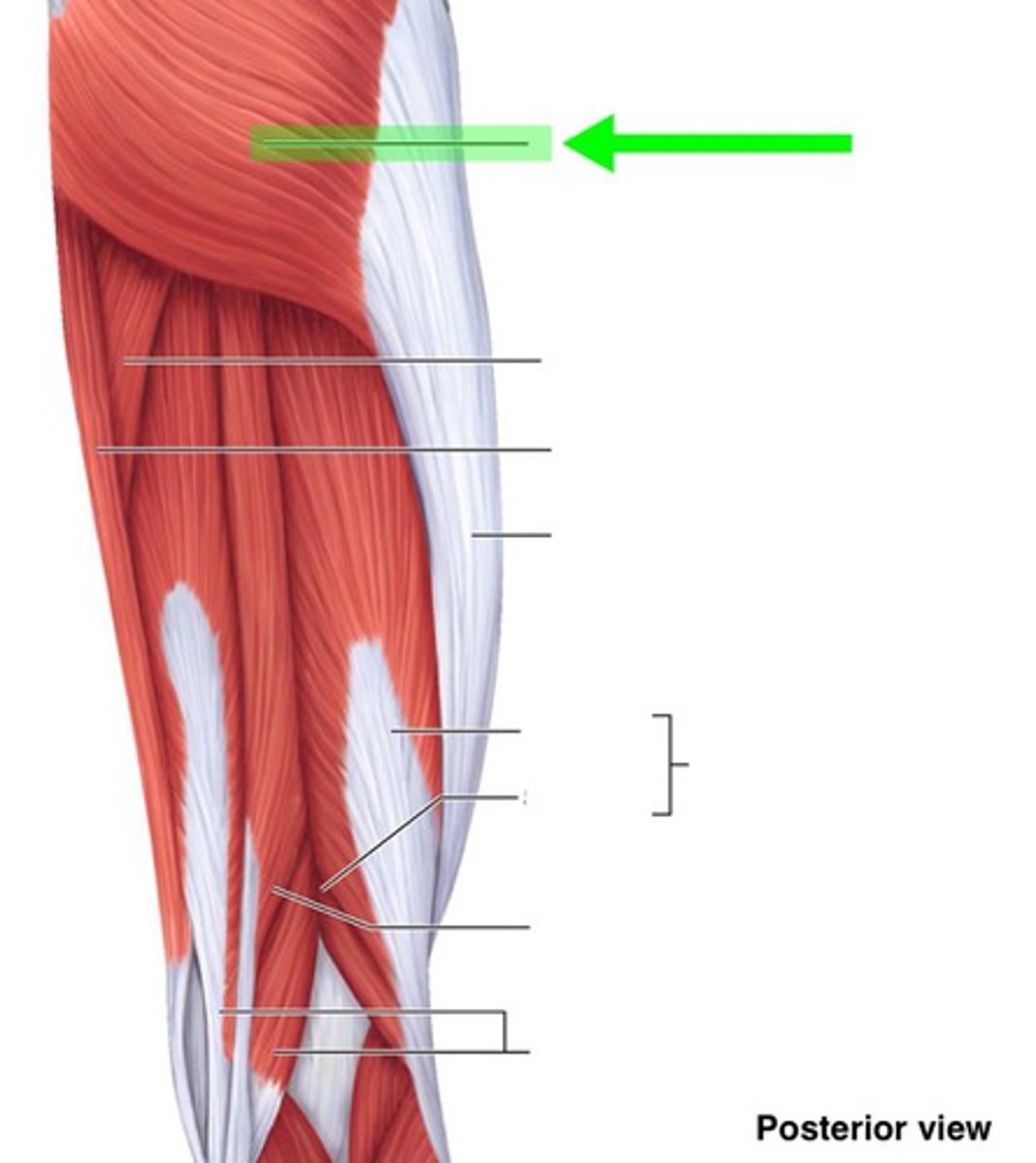 <p>What muscle is this?</p>