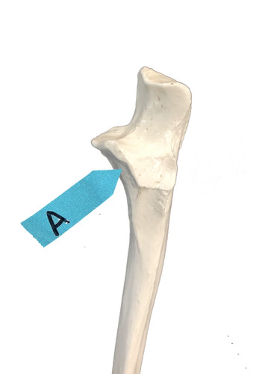 <p>Identify this bone marking.</p>