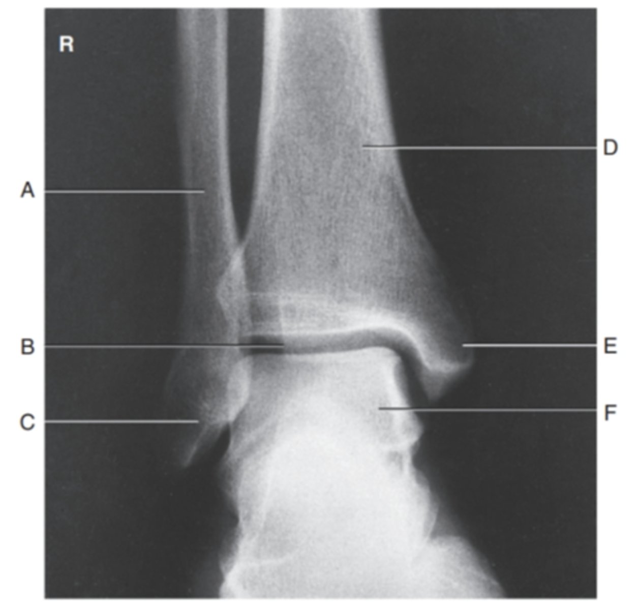 <p>(AP ANKLE) what is A?</p>