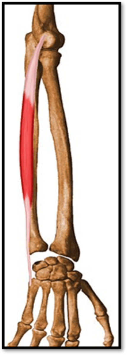 <p>What muscle is this?</p>
