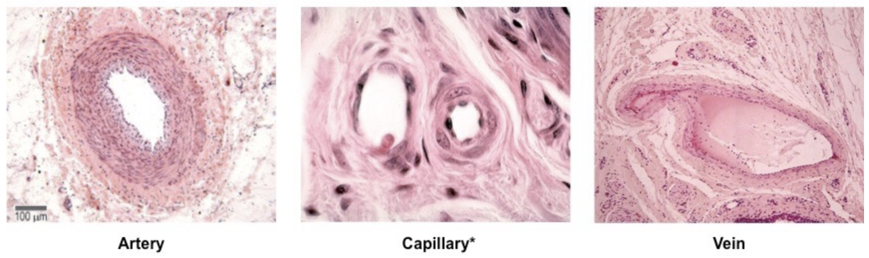 <p>arteries: thick walls (three distinct layers), narrow lumens, high blood pressure</p><p>capillaries: single cell thick wall for rapid exchange, extremely narrow lumen, low pressure</p><p>veins: thin walls, wide lumens, valves present, low blood pressure</p>