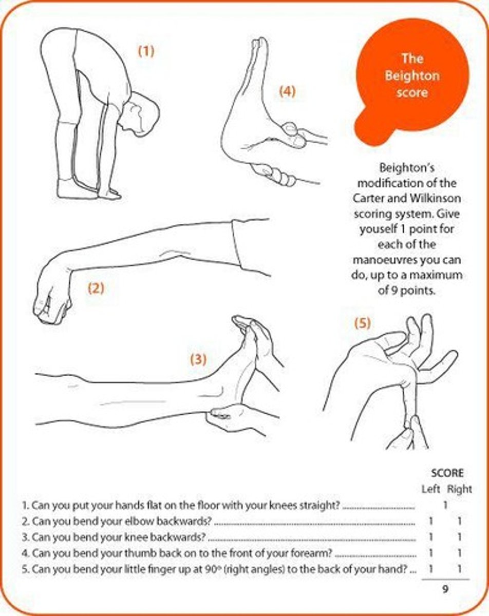 <p>To assess joint hypermobility in individuals.</p>