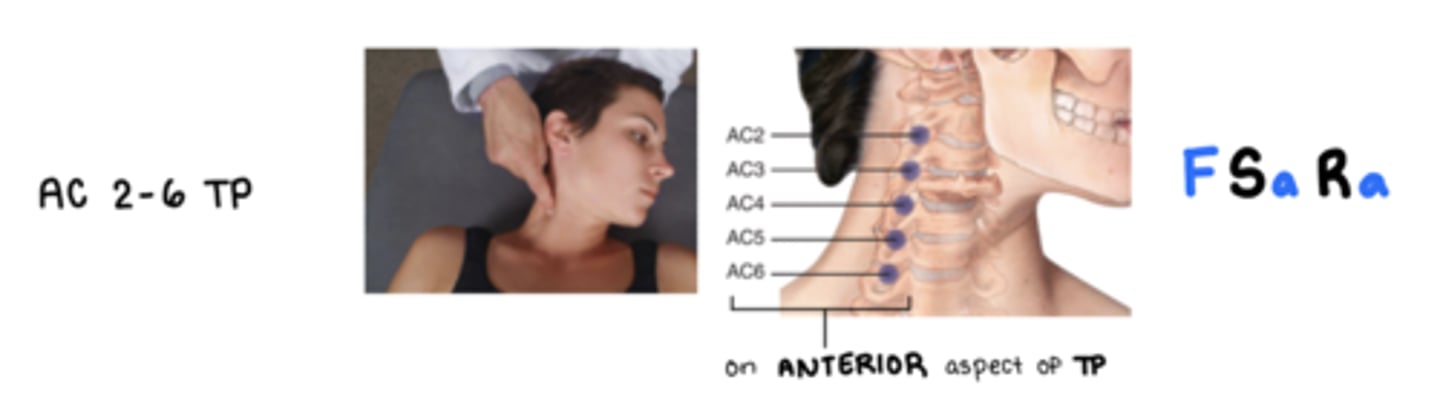 <p>F Sa Ra</p><p>on anterior lateral aspect of the A/P tubercles of the transverse process of the corresponding vertebrae</p><p>2- middle scalene and longus colli mm.</p><p>3/4- anterior, middle scalenes, longus capitis and longus colli mm.</p><p>5/6- anterior, middle, posterior scalenes, longus capitis and longus collii mm.</p>