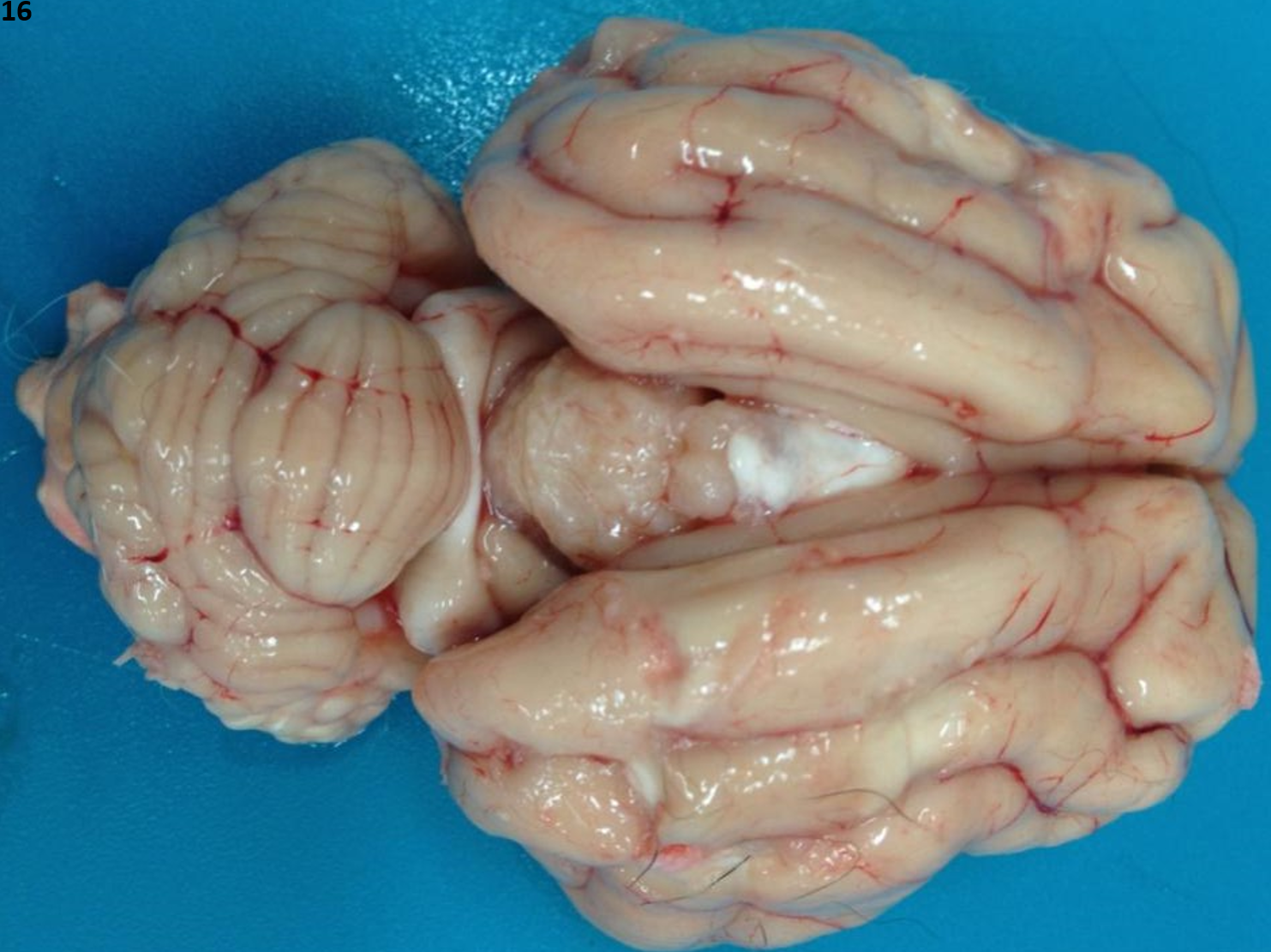 <p class="MsoNormal">16.<span>&nbsp; </span>Tissue from a cat.<span>&nbsp; </span>What is the most appropriate morphologic diagnosis?</p><ol type="a"><li><p>Meningioma</p></li><li><p>Feline cholesterol granuloma</p></li><li><p>Choroid plexus papilloma</p></li><li><p>Mutated feline coronavirus infection</p></li></ol><p></p>