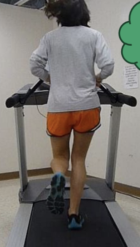 <p>Following surgery of the R hip, a patient ambulates as shown in the picture. To improve gait pattern, functional electrical stimulation should be initiated for which of the following?</p><ol><li><p>R abductors during swing on the R</p></li><li><p>R abductors during stance on the R</p></li><li><p>L abductors during stance on the L</p></li><li><p>L abductors during swing on the L</p></li></ol><p></p>