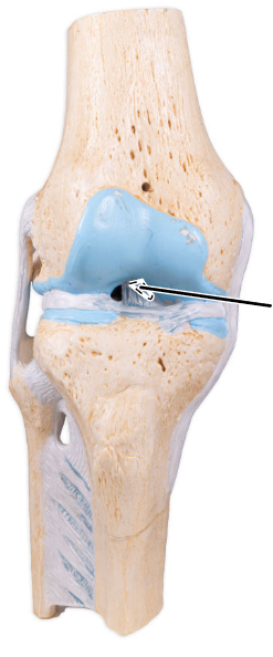 <p>What ligament is shown here?</p>