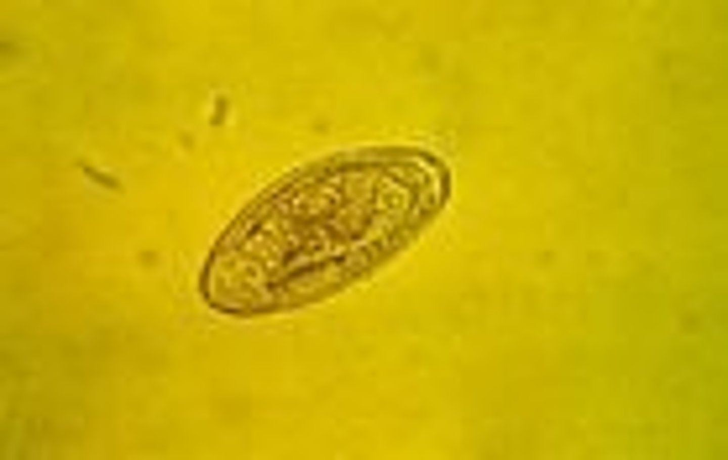 <p>Pinworm of horses</p>