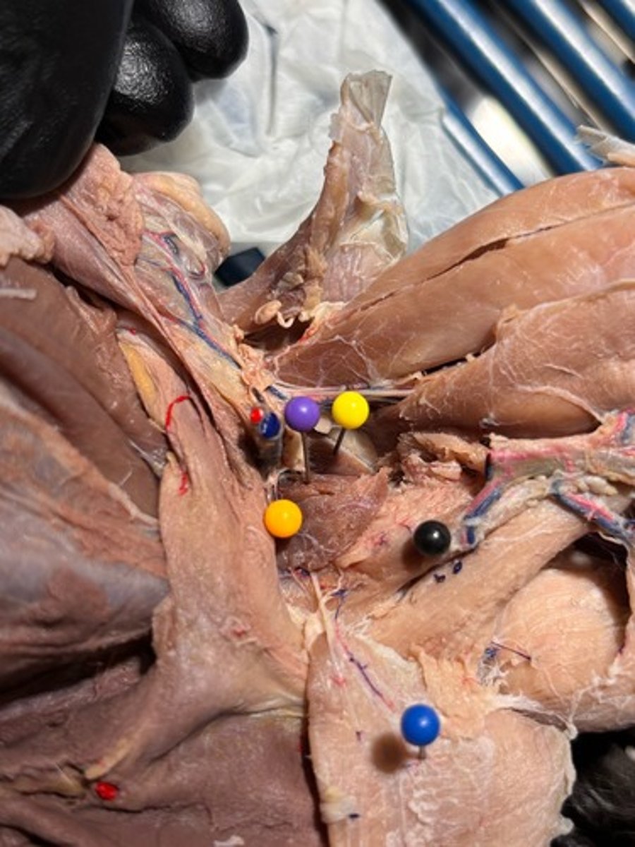 <p>What thigh muscle is the black pin in</p>