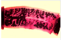 Mature proglottid of _____________, stained with _______. Note the number of primary uterine branches.