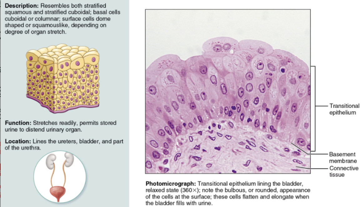 <ul><li><p><strong>DESCRIPTION</strong>: A modified stratified squamous epithelium</p></li><li><p><strong>FUNCTION</strong>: <span style="color: red">Adapted for responding to stretch</span></p></li><li><p><strong>LOCATION</strong>: It lines hollow <span style="color: green"><strong>urinary system organs</strong></span></p></li></ul><p></p>
