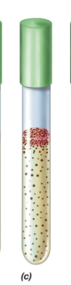 <p>Fluid Thioglycollate test- alot of colonies on top layer and some colonies on bottom layer</p>