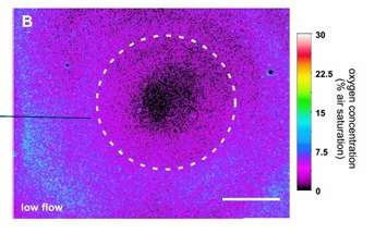 <p>Zuurstofgradiënt in biofilm afhankelijk van stroomsnelheid</p><p>GFP-gemarkeerde Pseudomonas putida, SYTO-gemarkeerde bacteriën</p><p>Centrale celcluster biofilm</p><ul><li><p>In midden biofilm: bijna 0% zuurstof</p></li><li><p><span style="font-family: "Times New Roman"; line-height: normal; font-size: 7pt;"> </span>Bact krijgen geen zuurstof en geen voedingsstoffen →slapen</p></li><li><p><span>AB: celwand synthese, eiwit synthese →</span>inwerken op groeiende levende actieve bact</p></li></ul><p></p>
