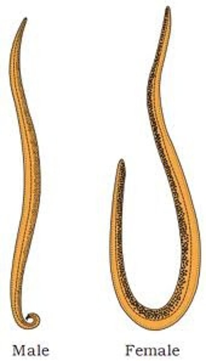 <p>Female: 20-35cm</p><p>Male: 15-31cm with curved posterior</p>