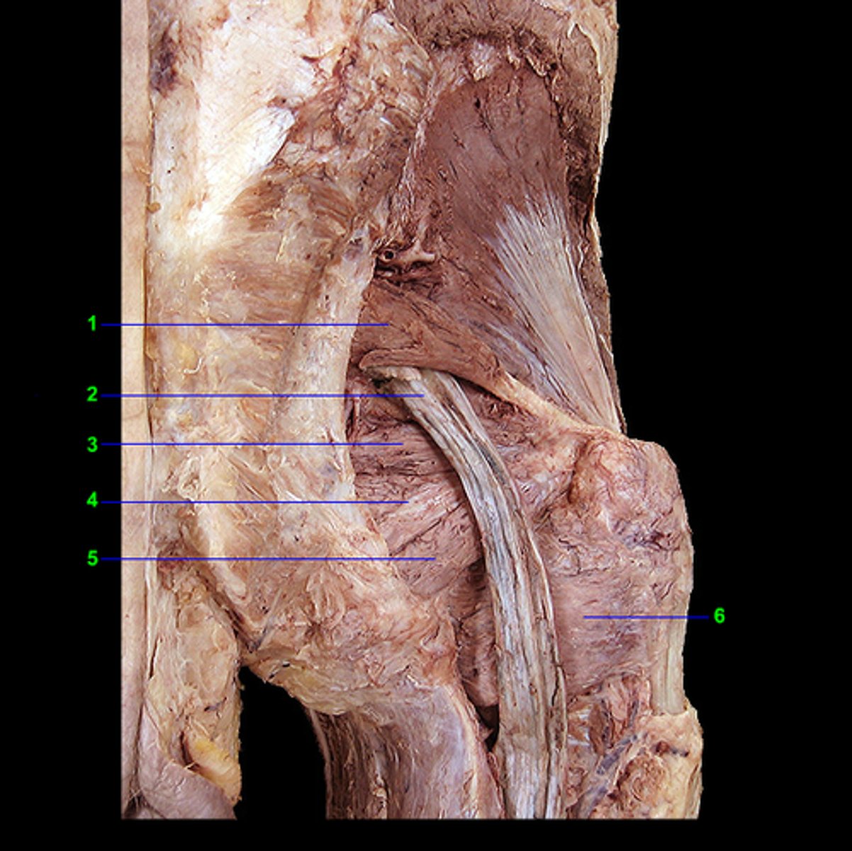 <p>obturator internus and superior gemellus</p>