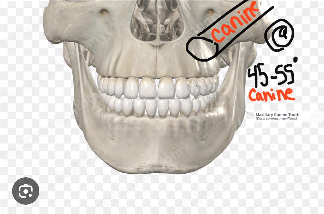 <p>Bisecting</p><ul><li><p>Canines maxillary</p></li></ul><p></p>