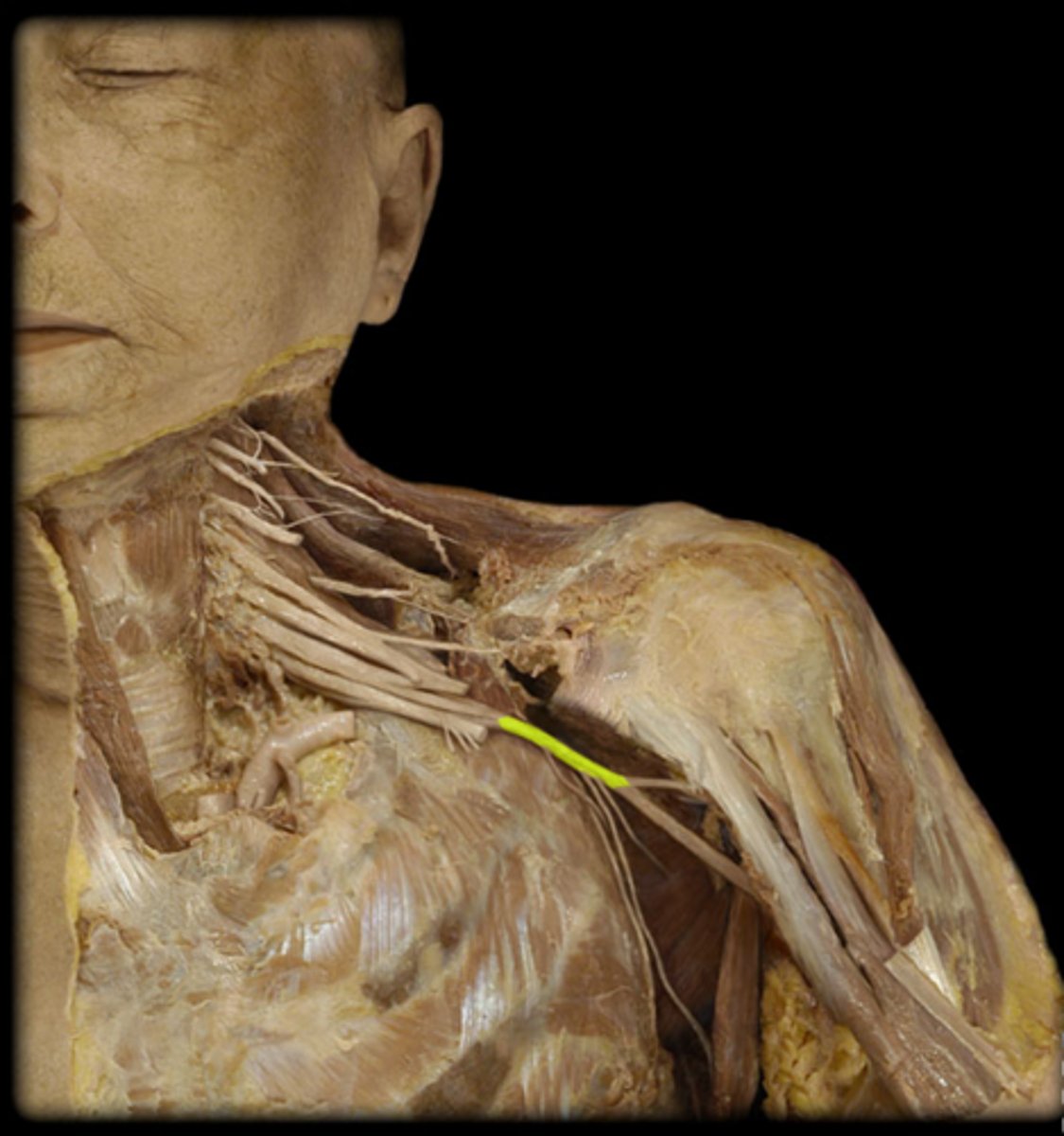 <p>What structure is shown?</p>