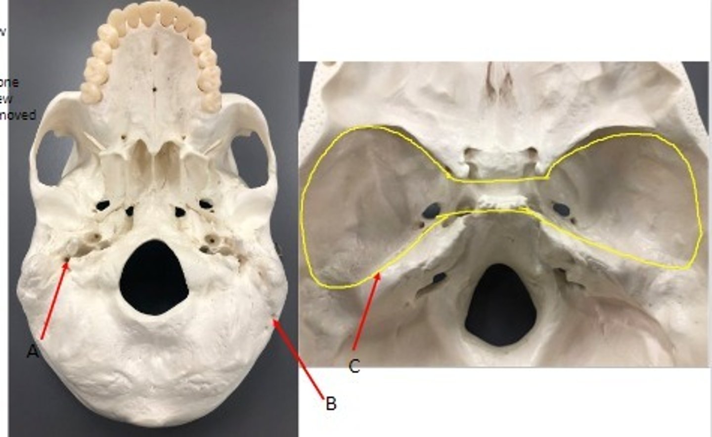 <p>What category of bone is it? What bone is it? Label the structures.</p>