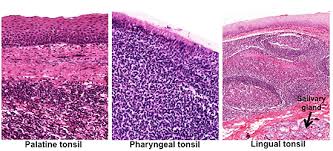 <p>What are the 3 MALT found in the mucosa of the Posterior Oral Cavity and Nasopharynx?</p>
