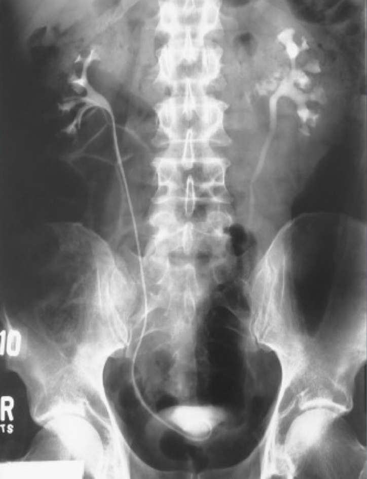 <p>What is this X-ray demonstrating?</p>