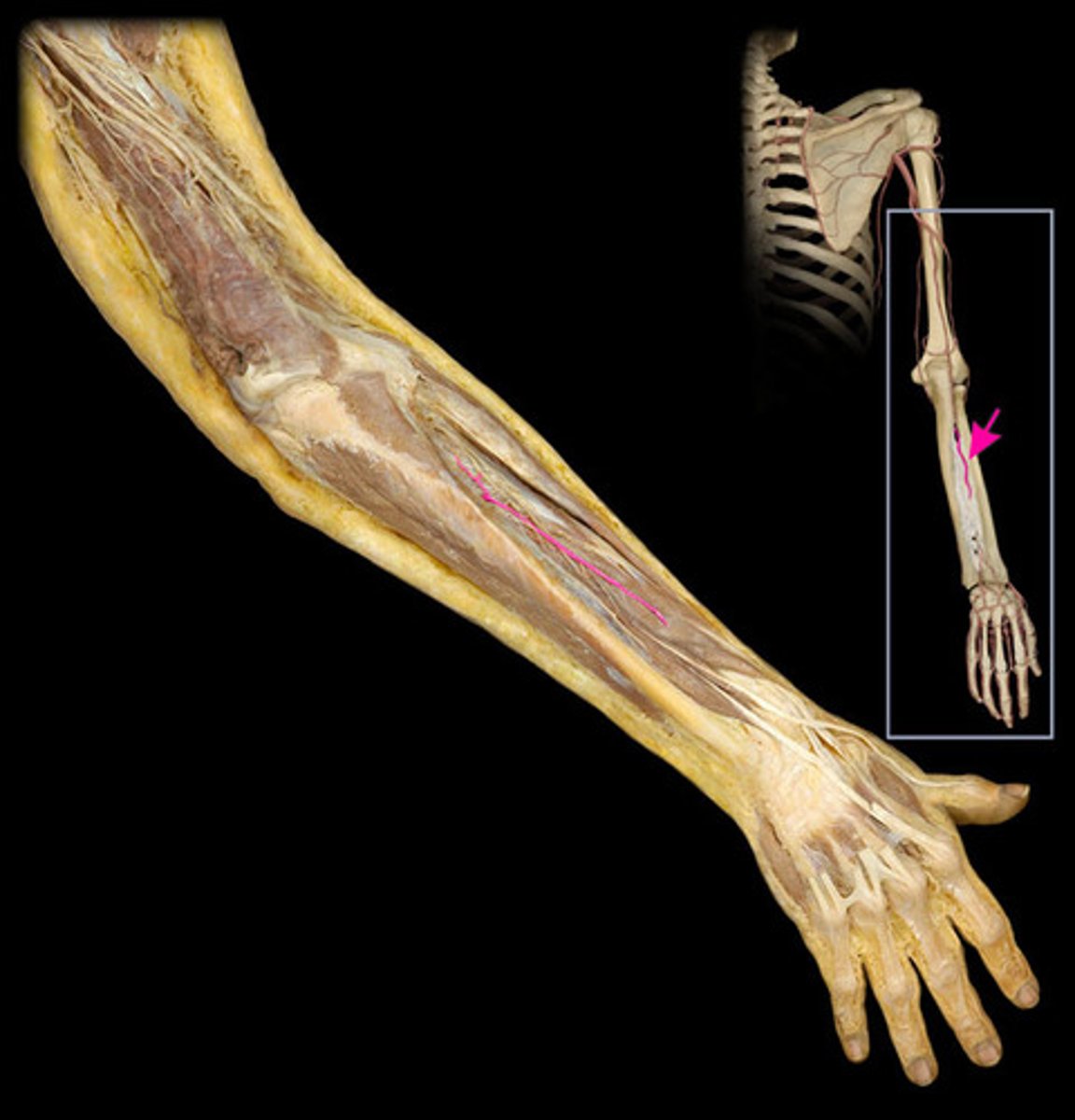 knowt flashcard image