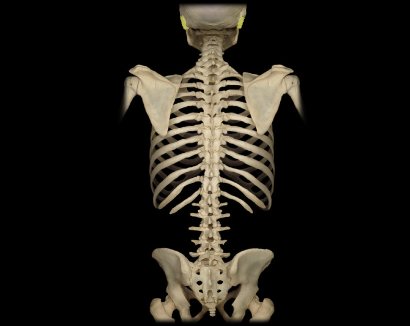 <p>Temporal bone</p>