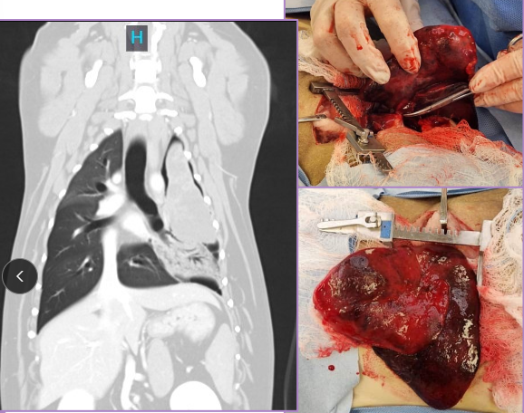 <p><span>Lung Lobe Torsion</span></p>