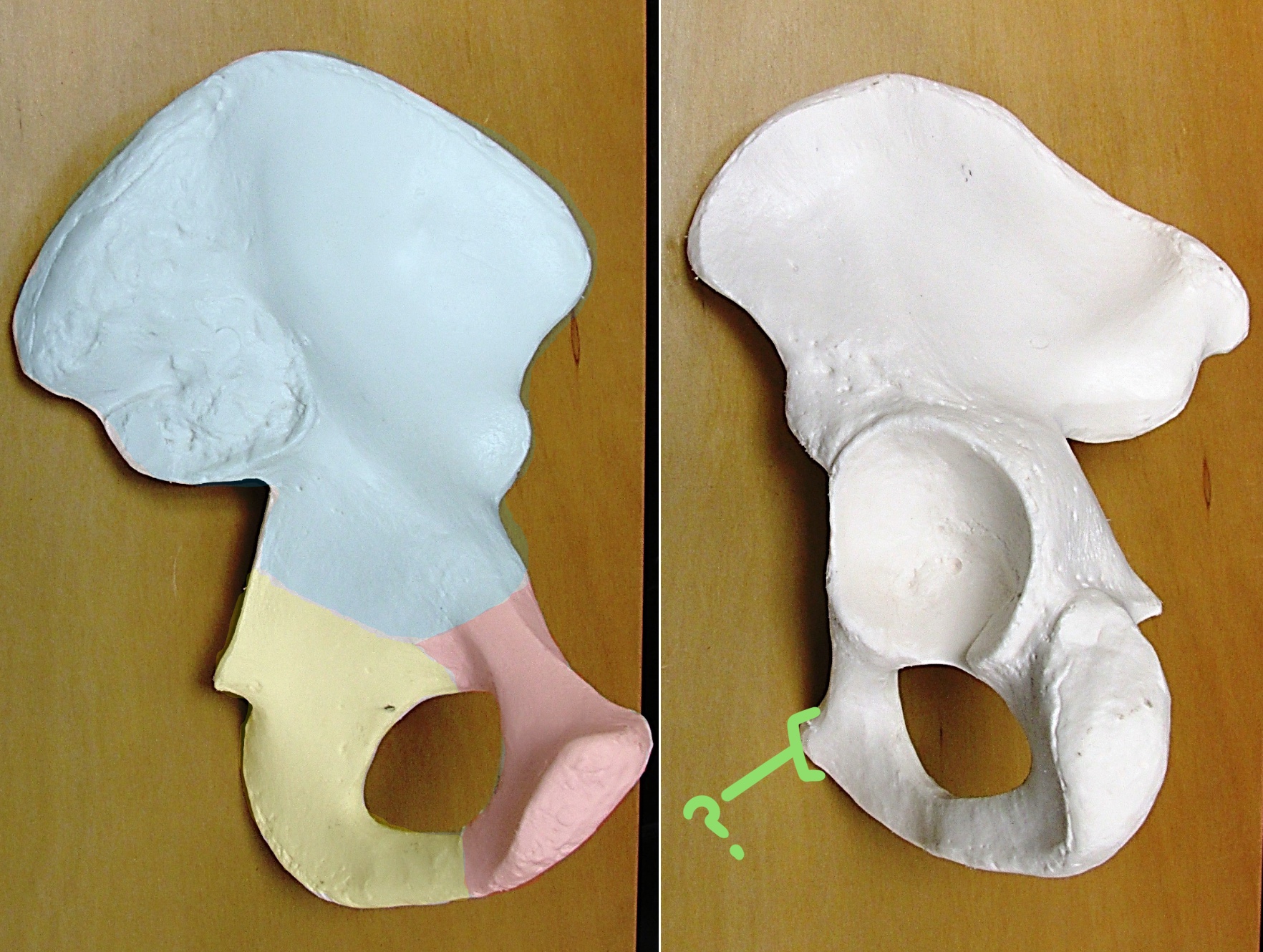 <p>Determine the part of the Coxa highlighted</p>