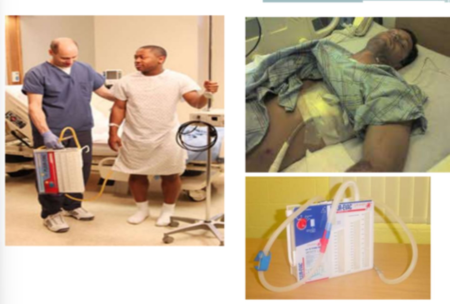 <p>Therapy Considerations for Chest Tubes:</p><p>- Do not ______________________ pleuroevac/drainage container</p><p>- Watch for kinks in tubing; do not sit on it</p><p>- Ensure no pulling/traction on tubing/no kinks</p><p>- Monitor ______________________ → Pre-medication prior to exercise may be helpful to encourage deep breathing</p><p>- Chest tube should be ________________________ level of insertion</p><p>- Portable _______________________ is an option</p>