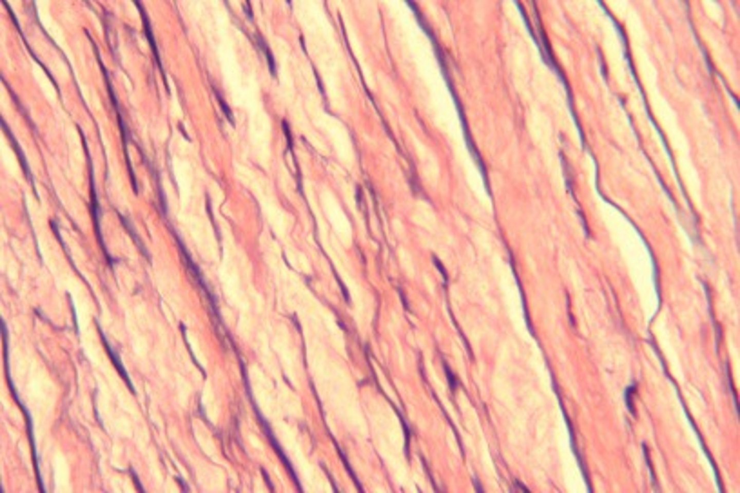 <p>Allows recoil after stretching — Walls of large arteries, ligamenta flava of vertebrae, bronchial tree</p>