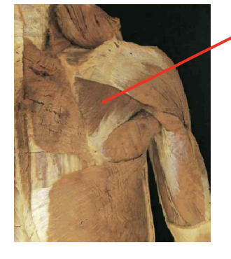 <p>What muscle is this? What is its origin. Where does it inserts. </p>