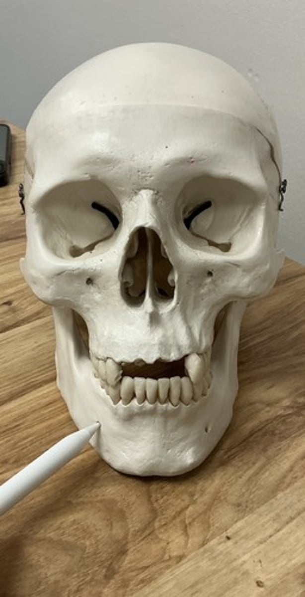 <p>What is the arrow pointing to?</p>