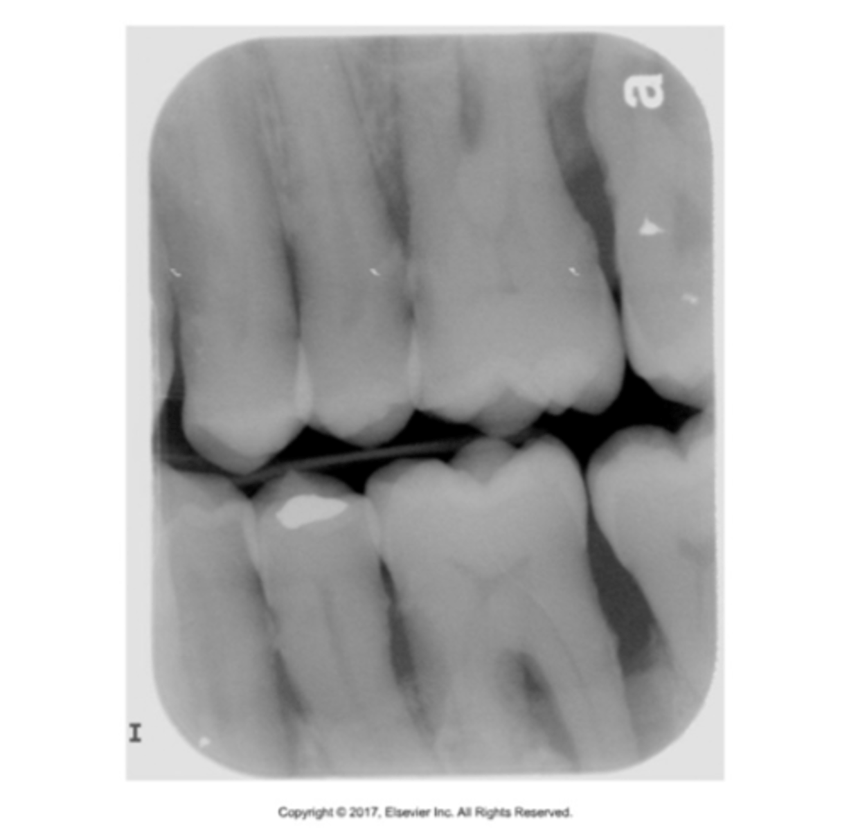 <p>take care to keep sensor clean</p><p>correct infection control procedures followed</p>