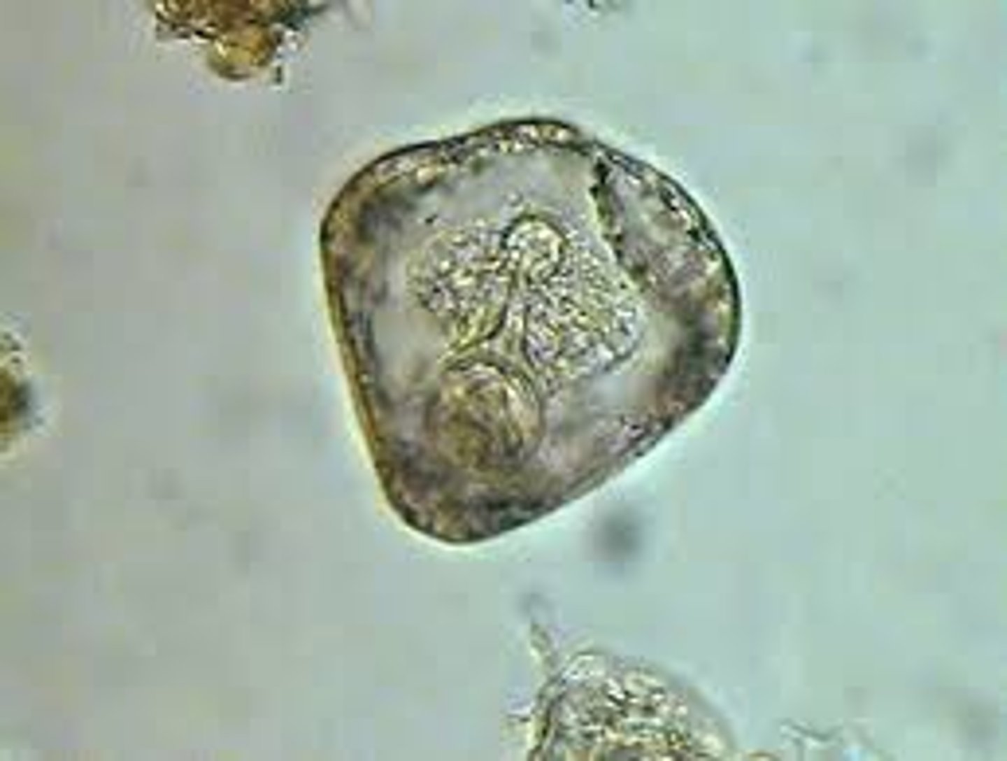 <p>Ruminant tapeworm</p>
