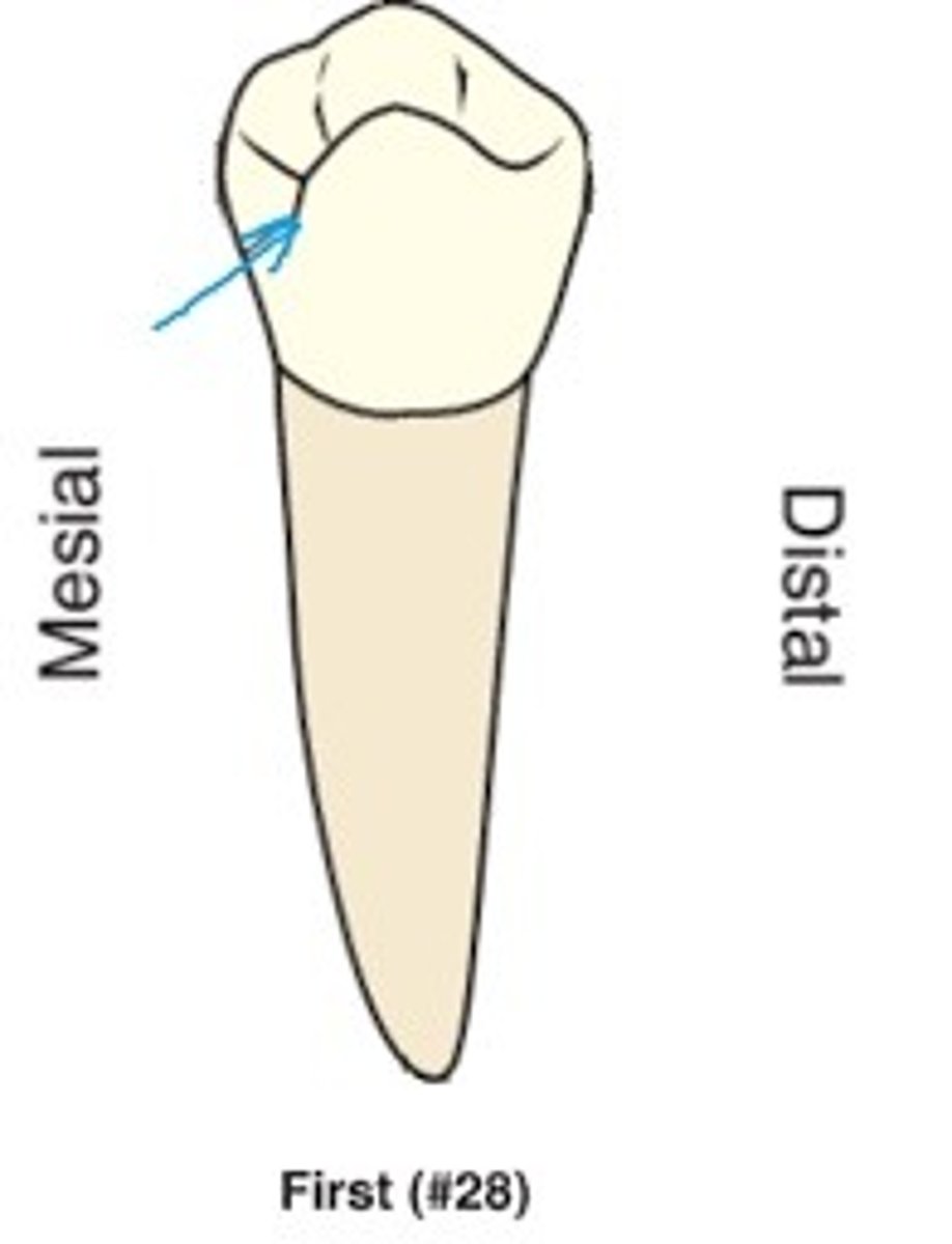<p>When compared to other premolars, which of the following characteristics is unique to a mandibular first premolar?</p>
