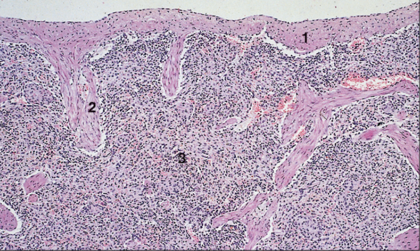 <p>spleen, horse</p>