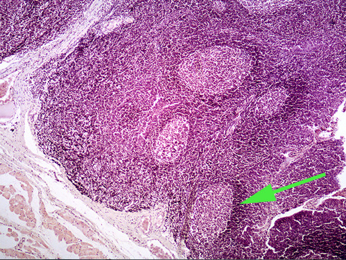<p><span>The light area surrounded by a thin dark area is called a</span><br><span><strong>lymphatic </strong>nodule.</span></p>