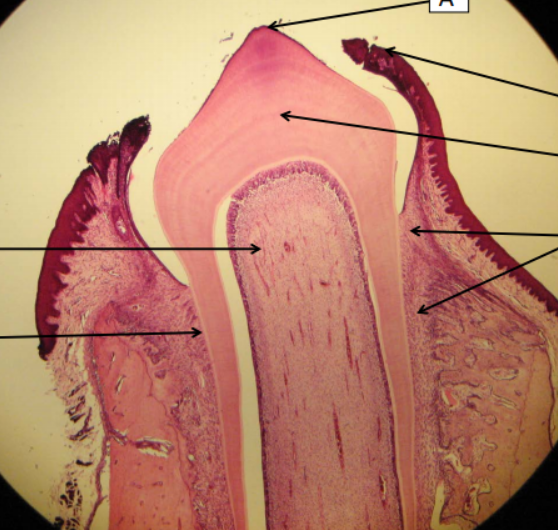 <p>Organ?</p>