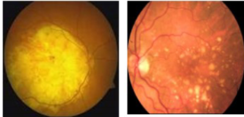 <p>Clinical scenario 1 </p>