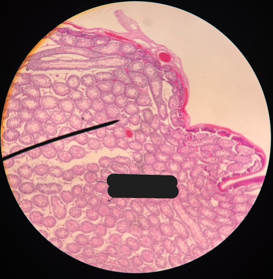 <p>Organ?</p>